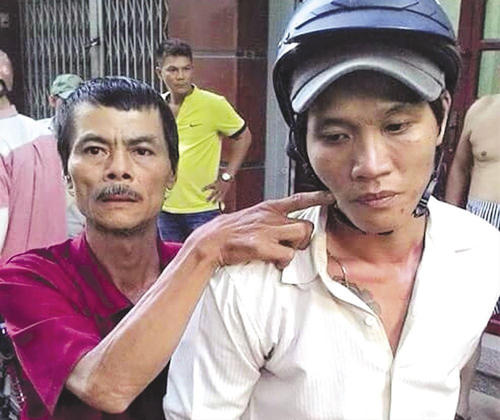 Chấn động khi băng trộm xe SH đâm 5 hiệp sĩ TP.HCM thương vong